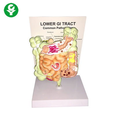 Senken Sie einzelne Paket-Größe des Magen-Darm-Trakt-allgemeine Pathologie-Modell-20X15X16 cm