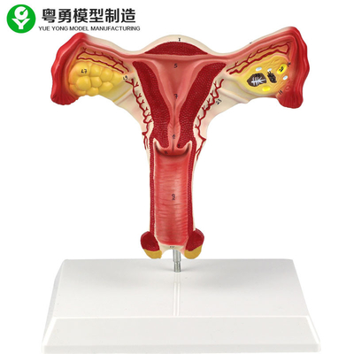 Menschlicher Gebärmutter-Eierstock-weibliches anatomisches vorbildliches vaginales Studenten-Lernen