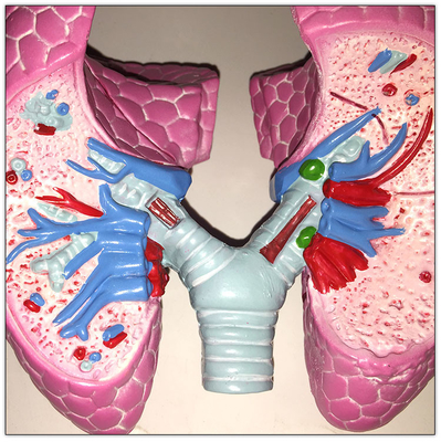 Plastik-COPD-Lungen-menschlicher Körper-Organ-Modell viszerales Lernen19x13x17cm